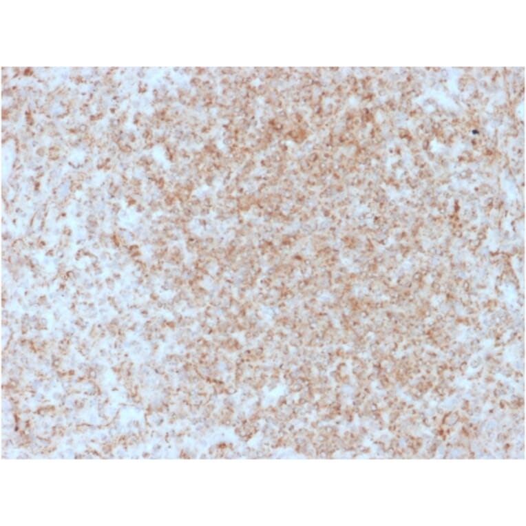 Immunohistochemistry - Anti-CD137 Antibody [4-1BB/3201] (A249029) - Antibodies.com