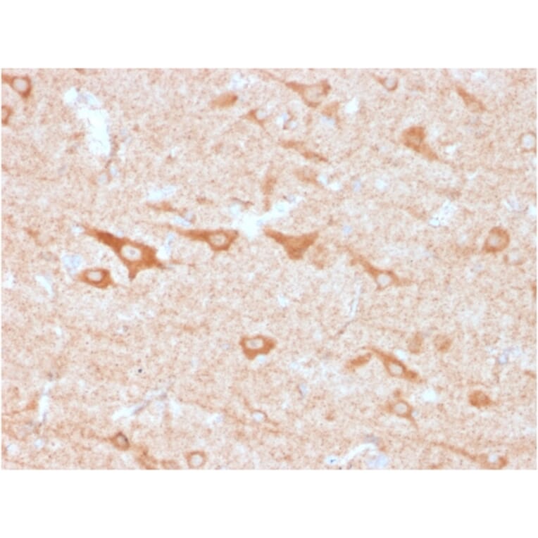 Immunohistochemistry - Anti-CD137 Antibody [4-1BB/3201] (A249029) - Antibodies.com