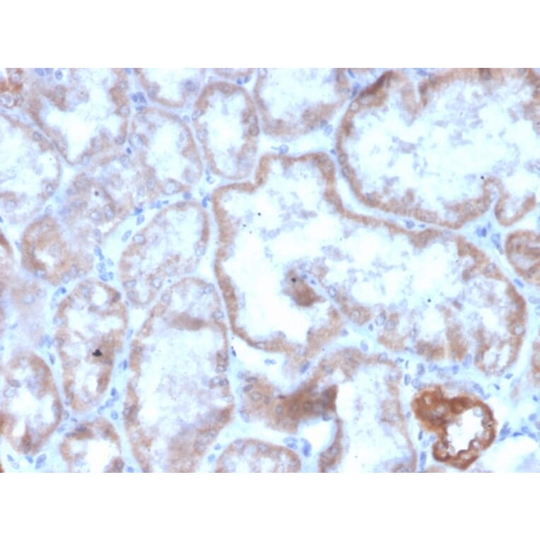 Immunohistochemistry - Anti-CD137 Antibody [r4-1BB/4603] (A249029) - Antibodies.com