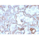 Immunohistochemistry - Anti-CD137 Antibody [r4-1BB/4603] (A249029) - Antibodies.com