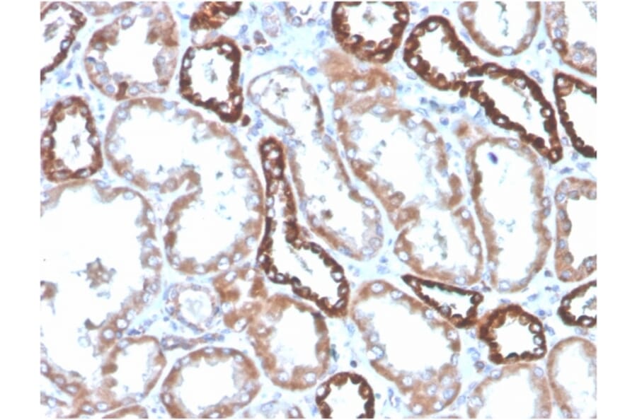 Immunohistochemistry - Anti-CD137 Antibody [4-1BB/4552R] (A249031) - Antibodies.com