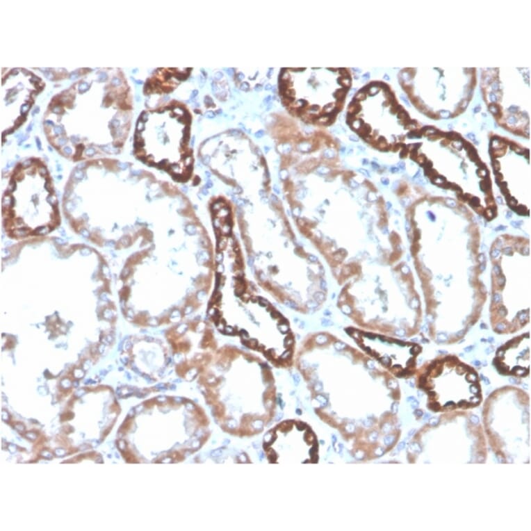 Immunohistochemistry - Anti-CD137 Antibody [4-1BB/4552R] (A249031) - Antibodies.com