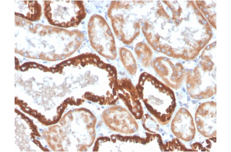 Immunohistochemistry - Anti-CD137 Antibody [4-1BB/4552R] (A249030) - Antibodies.com