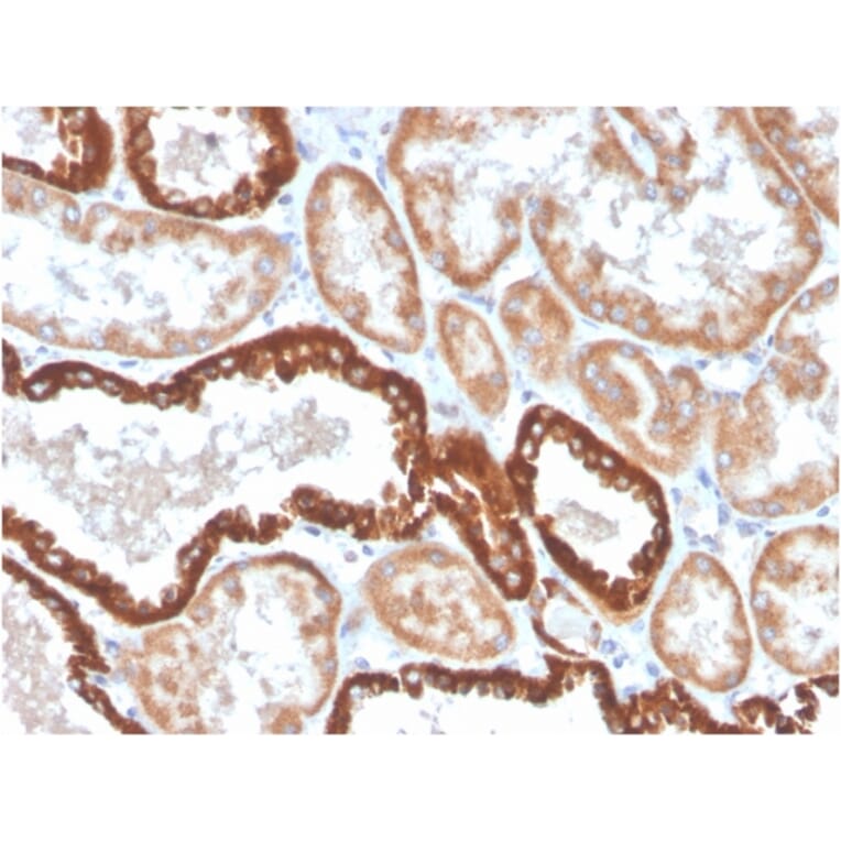 Immunohistochemistry - Anti-CD137 Antibody [4-1BB/4552R] (A249030) - Antibodies.com