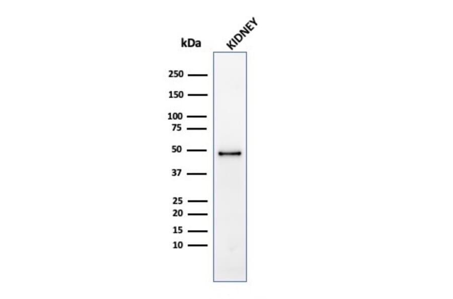 Western Blot - Anti-CD137 Antibody [4-1BB/4552R] (A249031) - Antibodies.com
