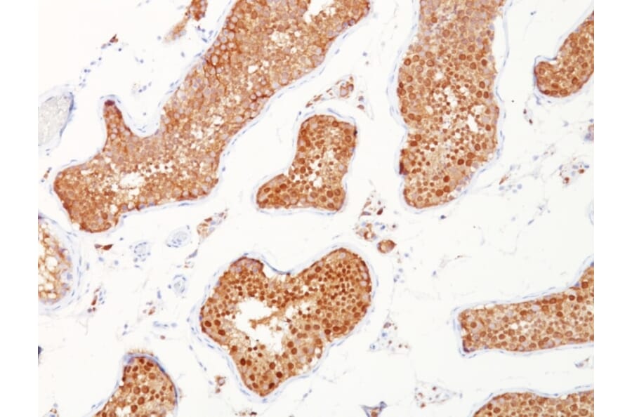 Immunohistochemistry - Anti-Inhibin alpha Antibody [INHA/1168] (A249031) - Antibodies.com