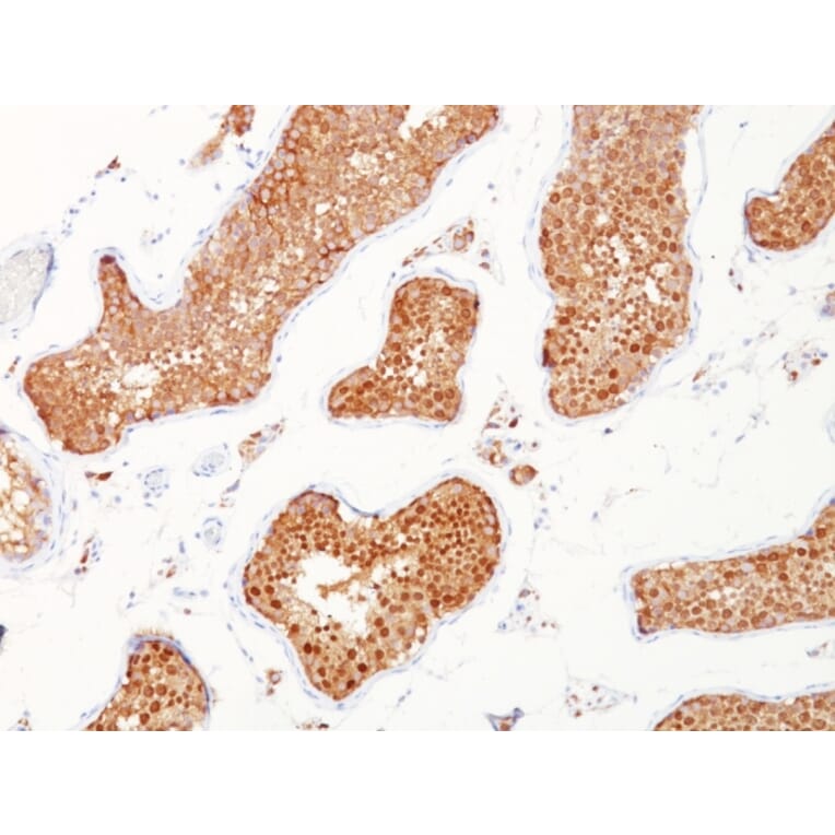 Immunohistochemistry - Anti-Inhibin alpha Antibody [INHA/1168] (A249031) - Antibodies.com