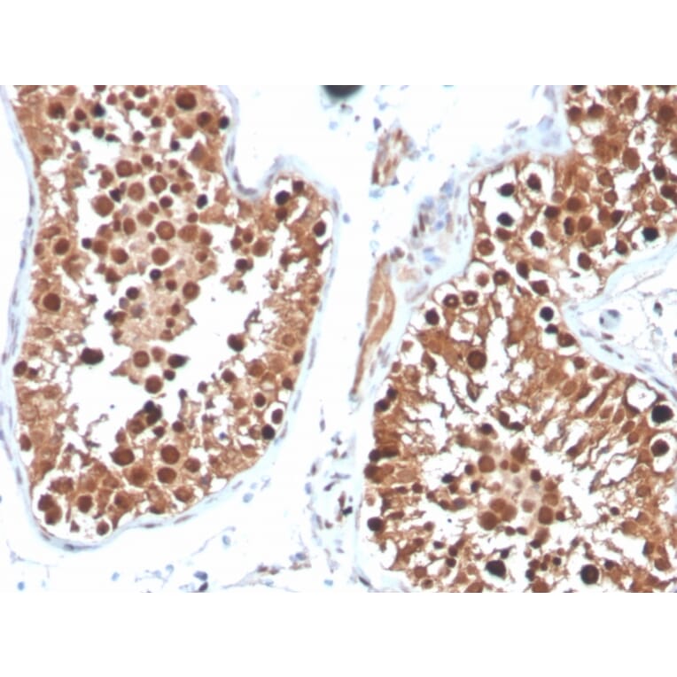 Immunohistochemistry - Anti-Inhibin alpha Antibody [INHA/4265] (A249033) - Antibodies.com