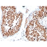 Immunohistochemistry - Anti-Inhibin alpha Antibody [INHA/4265] (A249033) - Antibodies.com