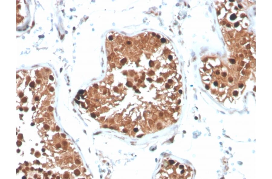 Immunohistochemistry - Anti-Inhibin alpha Antibody [INHA/4265] (A249032) - Antibodies.com