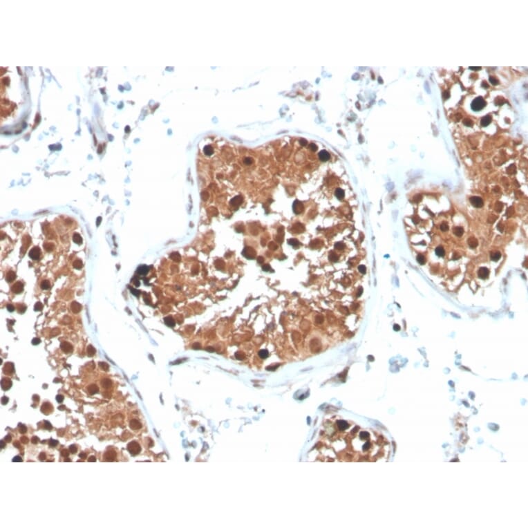 Immunohistochemistry - Anti-Inhibin alpha Antibody [INHA/4265] (A249032) - Antibodies.com