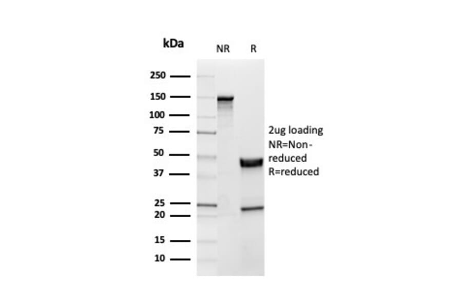 SDS-PAGE - Anti-Inhibin alpha Antibody [INHA/4265] (A249033) - Antibodies.com