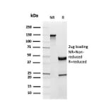 SDS-PAGE - Anti-Inhibin alpha Antibody [INHA/4265] (A249033) - Antibodies.com