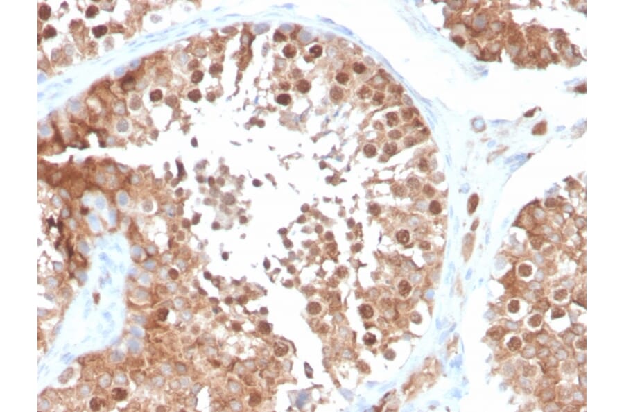 Immunohistochemistry - Anti-Inhibin alpha Antibody [INHA/4266] (A249034) - Antibodies.com