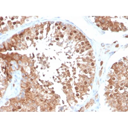 Immunohistochemistry - Anti-Inhibin alpha Antibody [INHA/4266] (A249034) - Antibodies.com