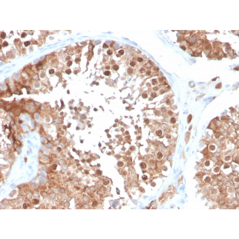 Immunohistochemistry - Anti-Inhibin alpha Antibody [INHA/4266] (A249034) - Antibodies.com