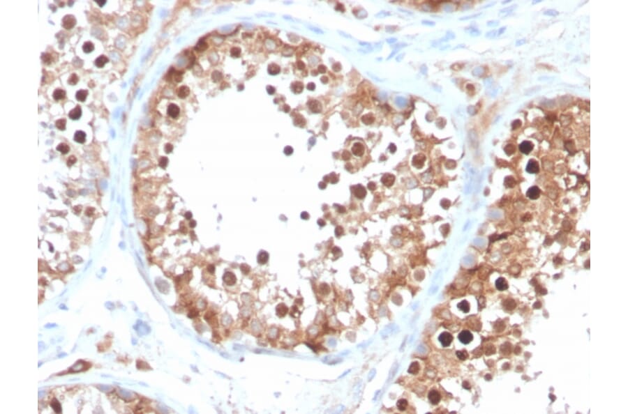 Immunohistochemistry - Anti-Inhibin alpha Antibody [INHA/4266] (A249033) - Antibodies.com