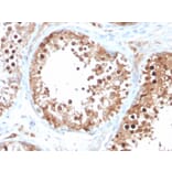 Immunohistochemistry - Anti-Inhibin alpha Antibody [INHA/4266] (A249033) - Antibodies.com