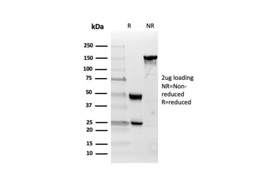SDS-PAGE - Anti-Inhibin alpha Antibody [INHA/4266] (A249034) - Antibodies.com