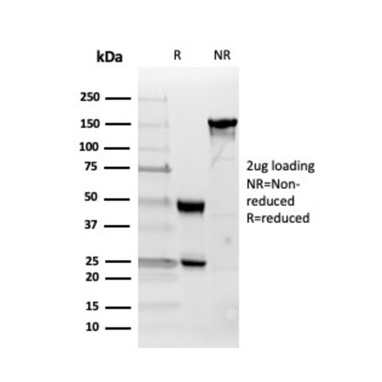 SDS-PAGE - Anti-Inhibin alpha Antibody [INHA/4266] (A249034) - Antibodies.com