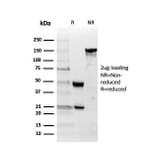 SDS-PAGE - Anti-Inhibin alpha Antibody [INHA/4266] (A249034) - Antibodies.com