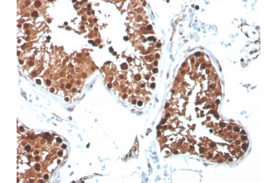Immunohistochemistry - Anti-Inhibin alpha Antibody [R1] (A249034) - Antibodies.com