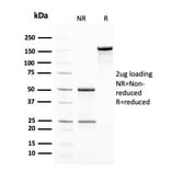 SDS-PAGE - Anti-Insulin Antibody [2D11-H5] (A249036) - Antibodies.com