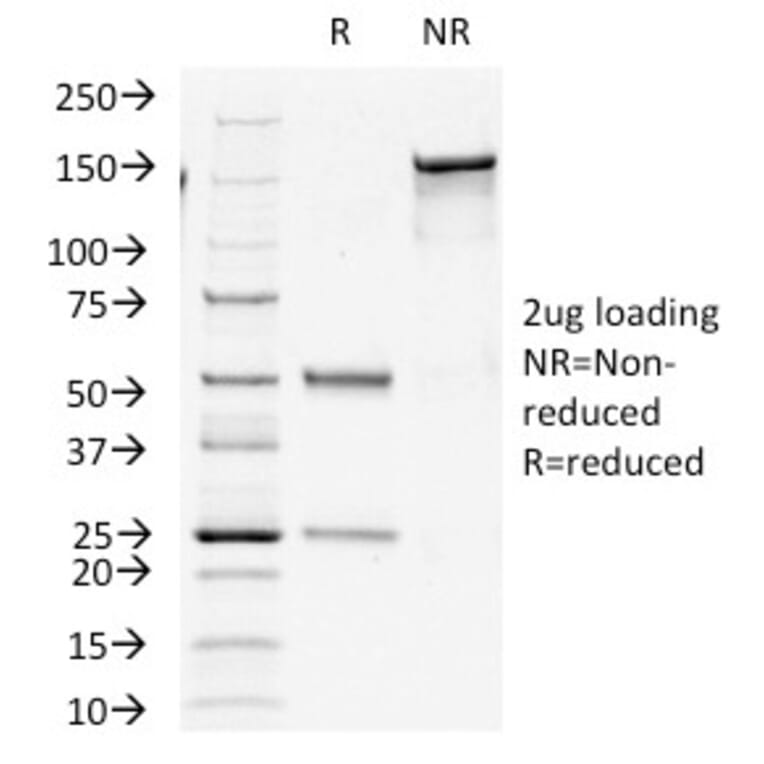 SDS-PAGE - Anti-Insulin Antibody [E2-E3+2D11-H5] (A249040) - Antibodies.com