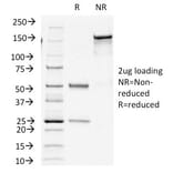 SDS-PAGE - Anti-Insulin Antibody [E2-E3+2D11-H5] (A249040) - Antibodies.com