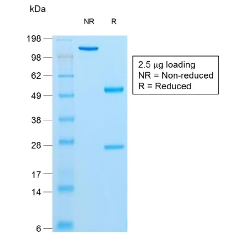 SDS-PAGE - Anti-Insulin Antibody [rIRDN/805] (A249044) - Antibodies.com