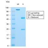 SDS-PAGE - Anti-Insulin Antibody [rIRDN/805] (A249044) - Antibodies.com