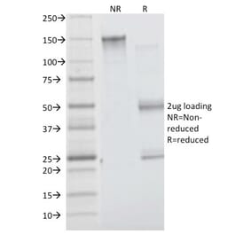 SDS-PAGE - Anti-Insulin Receptor alpha Antibody [INSR/1661] (A249045) - Antibodies.com