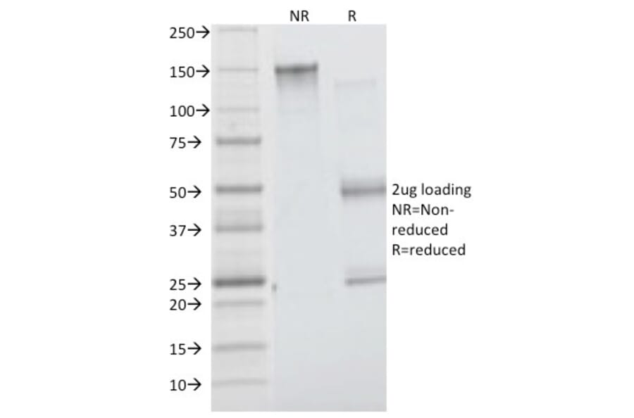 SDS-PAGE - Anti-Insulin Receptor alpha Antibody [INSR/1661] (A249045) - Antibodies.com
