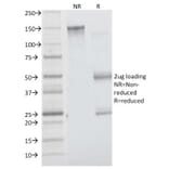 SDS-PAGE - Anti-Insulin Receptor alpha Antibody [INSR/1661] (A249045) - Antibodies.com