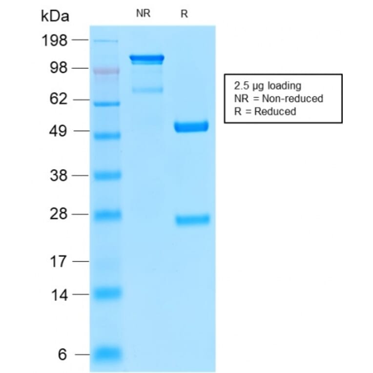 SDS-PAGE - Anti-Insulin Receptor alpha Antibody [INSR/2277R] (A249047) - Antibodies.com