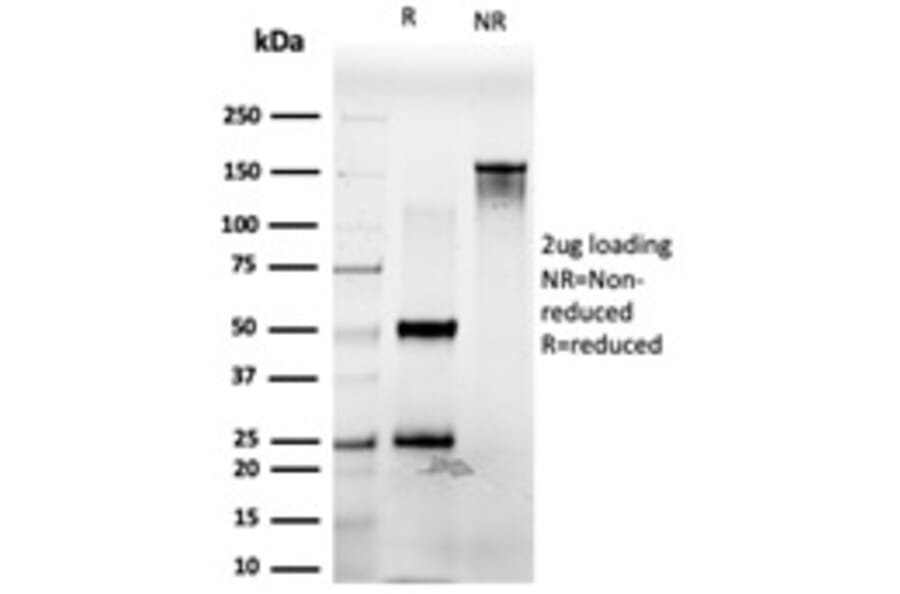 SDS-PAGE - Anti-PDX1 Antibody [PCRP-PDX1-2C11] (A249048) - Antibodies.com