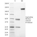 SDS-PAGE - Anti-CD41a Antibody [ITGA2B/1036] (A249051) - Antibodies.com