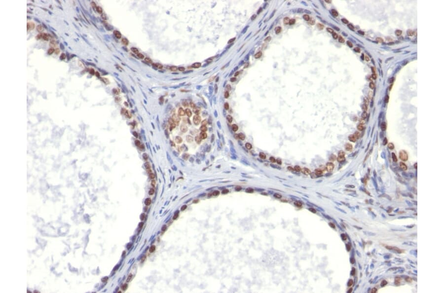 Immunohistochemistry - Anti-Androgen Receptor Antibody [AR441] (A249052) - Antibodies.com