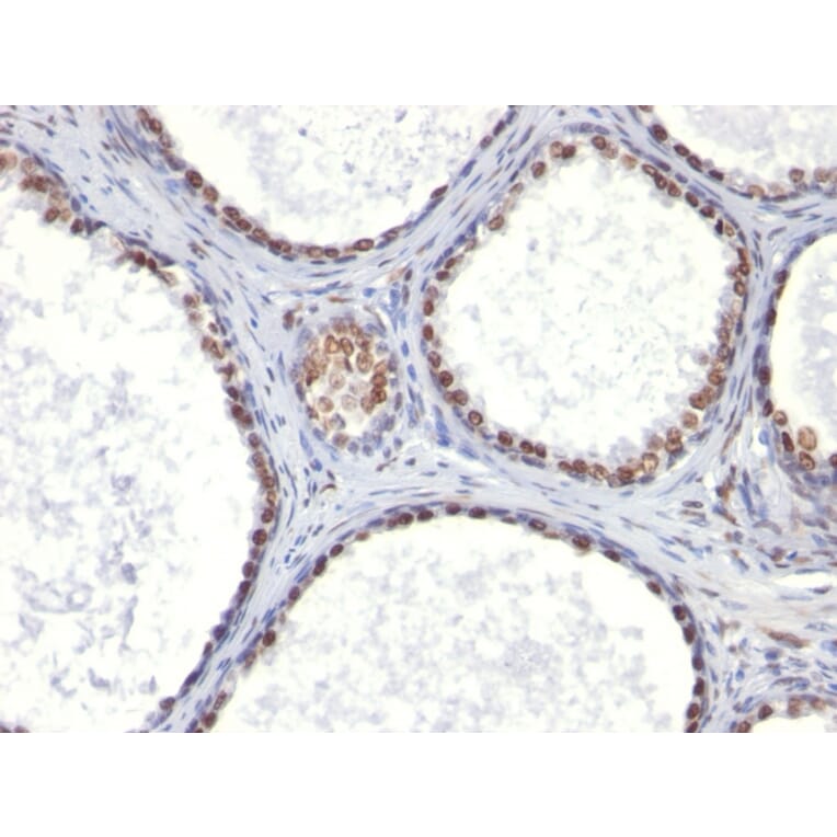 Immunohistochemistry - Anti-Androgen Receptor Antibody [AR441] (A249052) - Antibodies.com