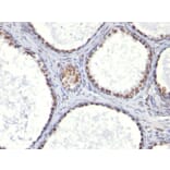 Immunohistochemistry - Anti-Androgen Receptor Antibody [AR441] (A249052) - Antibodies.com