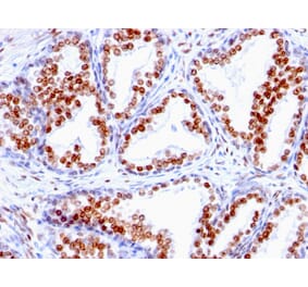 Immunohistochemistry - Anti-Androgen Receptor Antibody [SPM335] (A249053) - Antibodies.com