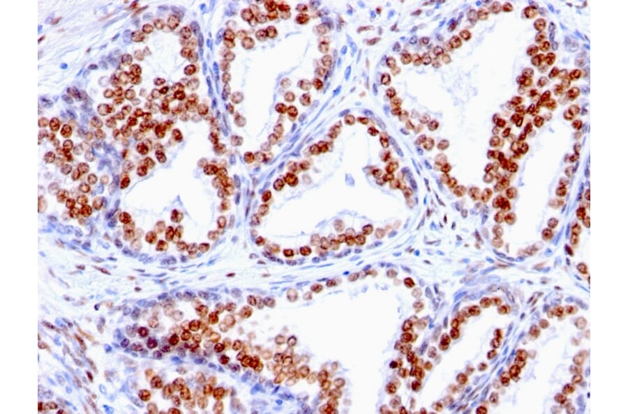 Immunohistochemistry - Anti-Androgen Receptor Antibody [SPM335] (A249053) - Antibodies.com