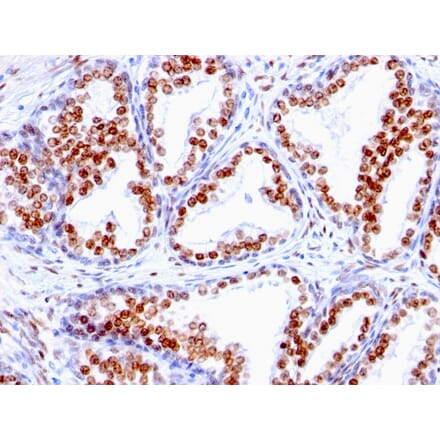 Immunohistochemistry - Anti-Androgen Receptor Antibody [SPM335] (A249053) - Antibodies.com