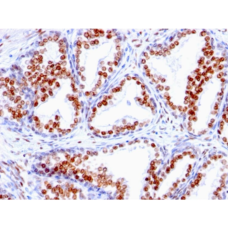 Immunohistochemistry - Anti-Androgen Receptor Antibody [SPM335] (A249053) - Antibodies.com