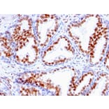Immunohistochemistry - Anti-Androgen Receptor Antibody [SPM335] (A249053) - Antibodies.com
