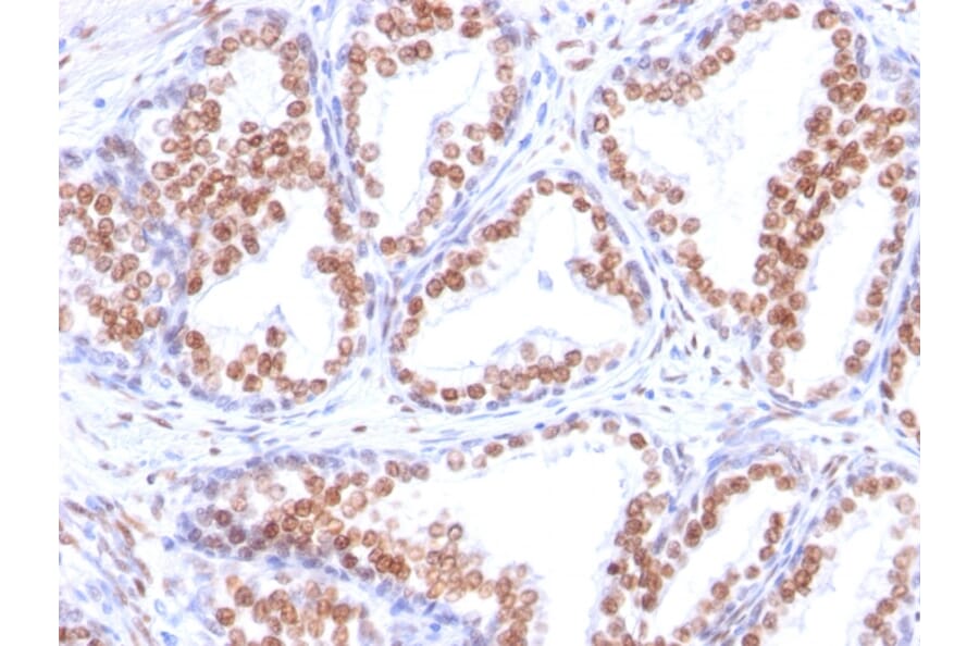 Immunohistochemistry - Anti-Androgen Receptor Antibody [DHTR/882] (A249054) - Antibodies.com