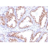 Immunohistochemistry - Anti-Androgen Receptor Antibody [DHTR/882] (A249054) - Antibodies.com