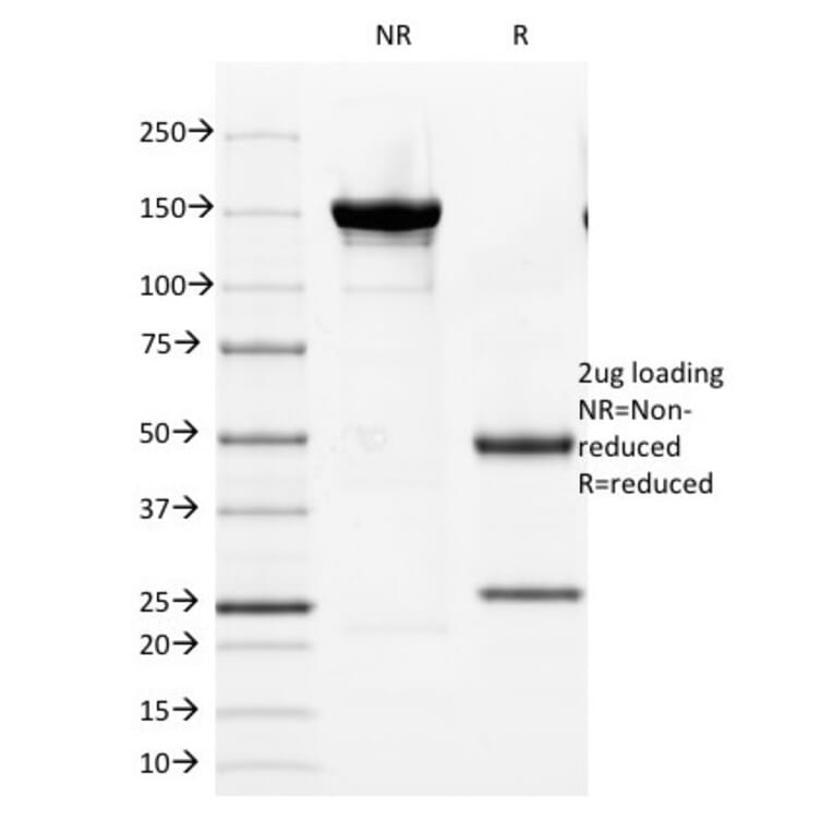 SDS-PAGE - Anti-Androgen Receptor Antibody [DHTR/882] (A249055) - Antibodies.com