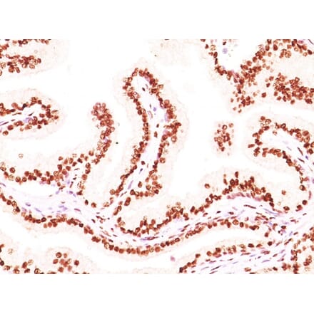 Immunohistochemistry - Anti-Androgen Receptor Antibody [AR441 + DHTR/882] (A249055) - Antibodies.com