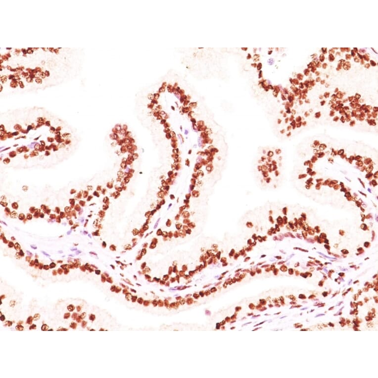 Immunohistochemistry - Anti-Androgen Receptor Antibody [AR441 + DHTR/882] (A249055) - Antibodies.com